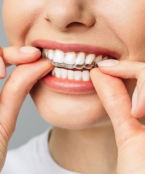 Cost of Invisalign Orthodontics of West Nyack in West Nyack, NY