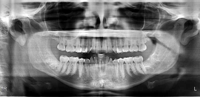 Xray Orthodontics of West Nyack in West Nyack, NY